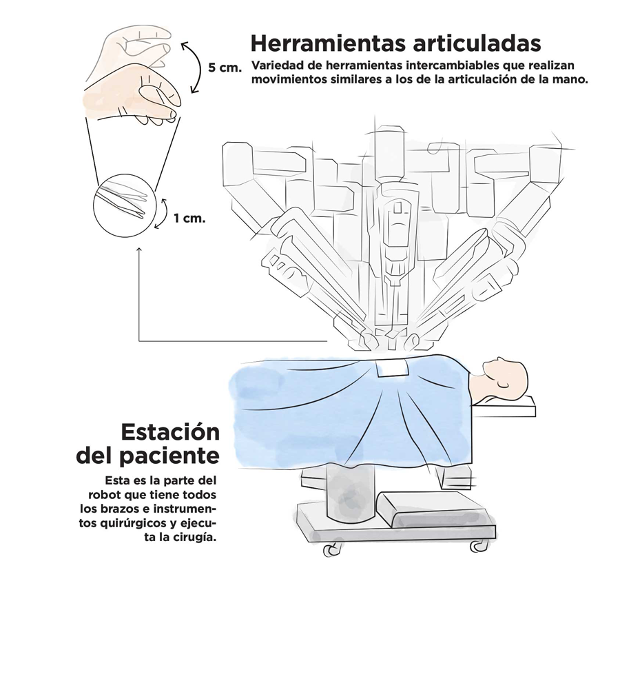 Nuestro robot Da Vinci